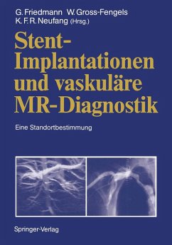 Cover Stent-Implantationen und vaskuläre MR-Diagnostik (eBook, PDF)
