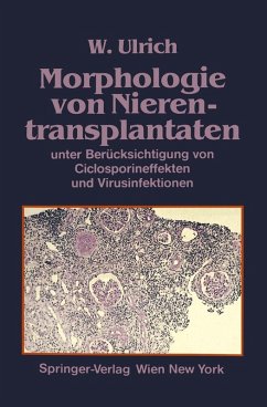 Cover Morphologie von Nierentransplantaten (eBook, PDF)