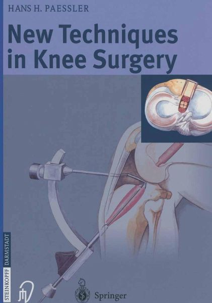 New Techniques in Knee Surgery (eBook, PDF) New Techniques in Knee Surgery (eBook, PDF)