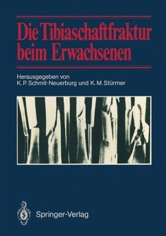 Cover Die Tibiaschaftfraktur beim Erwachsenen (eBook, PDF)