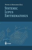 Systemic Lupus Erythematosus (eBook, PDF)