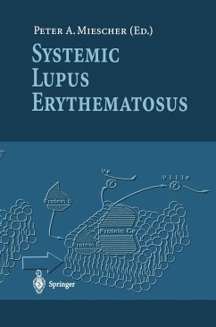 Cover Systemic Lupus Erythematosus (eBook, PDF)