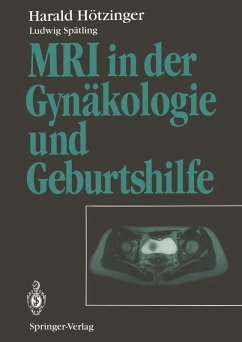 MRI in der Gynäkologie und Geburtshilfe (eBook, PDF) - Hötzinger, Harald