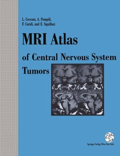 Cover MRI Atlas of Central Nervous System Tumors (eBook, PDF)
