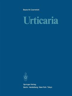 Urticaria (eBook, PDF) - Czarnetzki, Beate M.