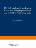Die Vulva und ihre Erkrankungen, Lage- und Bewegungsanomalien des weiblichen Genitalapparates (eBook, PDF)