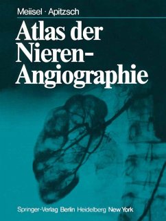 Atlas der Nierenangiographie (eBook, PDF) - Meiisel, P.; Apitzsch, D. E.