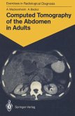 Computed Tomography of the Abdomen in Adults (eBook, PDF)
