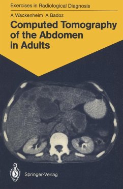 Cover Computed Tomography of the Abdomen in Adults (eBook, PDF)