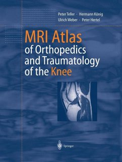 MRI Atlas of Orthopedics and Traumatology of the Knee (eBook, PDF) - Teller, Peter; König, Hermann; Weber, Ulrich; Hertel, Peter