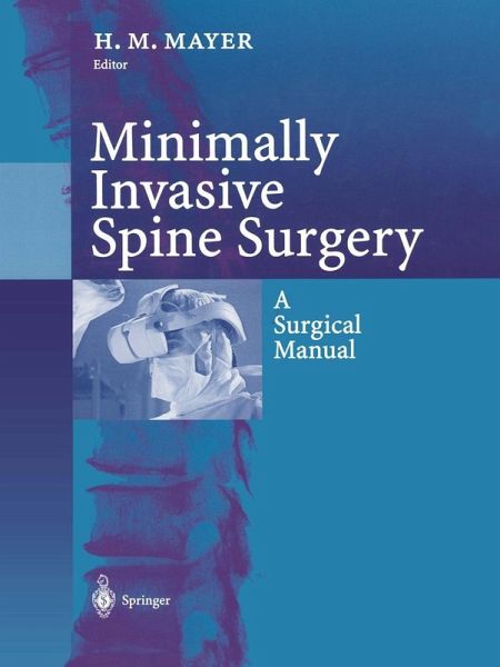 Minimally Invasive Spine Surgery (eBook, PDF)