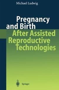 Pregnancy and Birth After Assisted Reproductive Technologies (eBook, PDF) - Ludwig, Michael