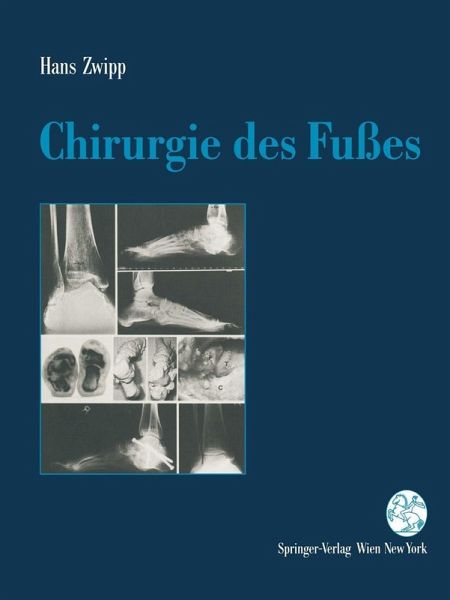 Chirurgie des Fußes (eBook, PDF) Chirurgie des Fußes (eBook, PDF)
