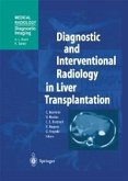 Diagnostic and Interventional Radiology in Liver Transplantation (eBook, PDF)