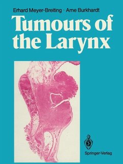 Cover Tumours of the Larynx (eBook, PDF)