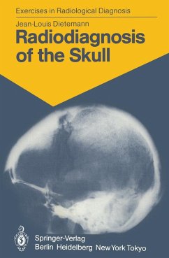 Radiodiagnosis of the Skull (eBook, PDF) - Dietemann, J. -L.