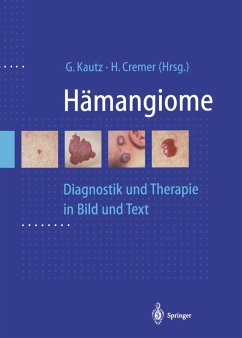Hämangiome (eBook, PDF)