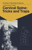 Cervical Spine: Tricks and Traps (eBook, PDF)