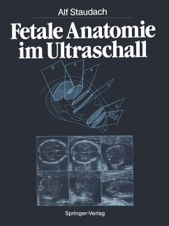 Fetale Anatomie im Ultraschall (eBook, PDF) - Staudach, Alf