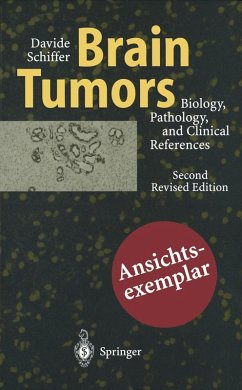 Brain Tumors (eBook, PDF) Cover Brain Tumors (eBook, PDF)