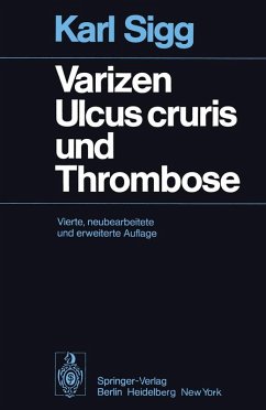 Varizen · Ulcus cruris und Thrombose (eBook, PDF) - Sigg, K.