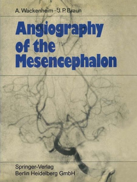 Angiography of the Mesencephalon (eBook, PDF) Angiography of the Mesencephalon (eBook, PDF)