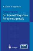 Kompendium der traumatologischen Röntgendiagnostik (eBook, PDF)
