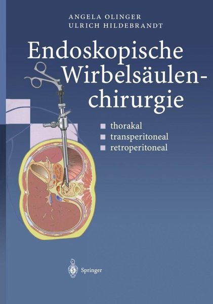 Endoskopische Wirbelsäulenchirurgie (eBook, PDF) Endoskopische Wirbelsäulenchirurgie (eBook, PDF)