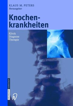 Cover Knochenkrankheiten (eBook, PDF)
