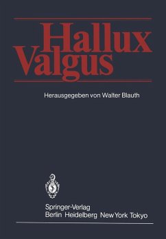 Hallux Valgus (eBook, PDF)