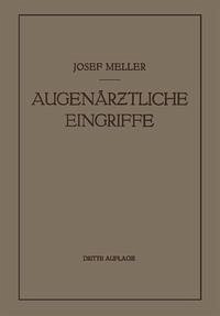 Cover Augenärztliche Eingriffe (eBook, PDF)