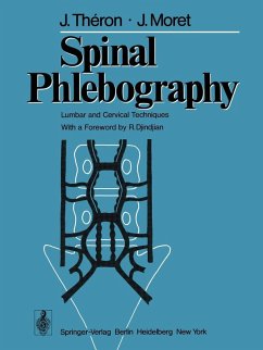 Spinal Phlebography (eBook, PDF) Cover Spinal Phlebography (eBook, PDF)