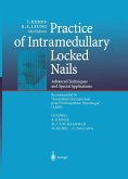 Practice of Intramedullary Locked Nails (eBook, PDF)