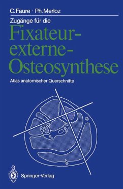 Zugänge für die Fixateur-externe-Osteosynthese (eBook, PDF) - Faure, Claude; Merloz, Philippe