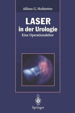 Cover Laser in der Urologie (eBook, PDF)