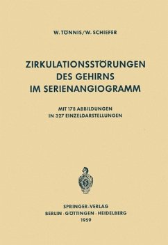 Zirkulationsstörungen des Gehirns im Serienangiogramm (eBook, PDF) - Tönnis, W.; Schiefer, W.