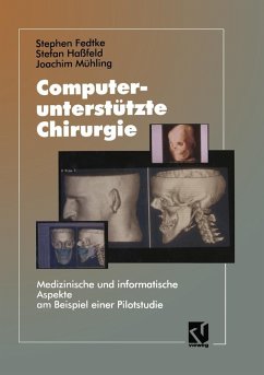 Computerunterstützte Chirurgie (eBook, PDF) - Fedtke, Stephen