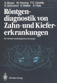 Röntgendiagnostik von Zahn- und Kiefererkrankungen (eBook, PDF)