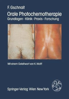 Cover Orale Photochemotherapie (eBook, PDF)