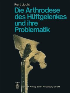 Cover Die Arthrodese des Hüftgelenkes und ihre Problematik (eBook, PDF)