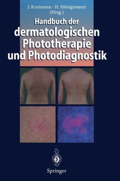 Cover Handbuch der dermatologischen Phototherapie und Photodiagnostik (eBook, PDF)