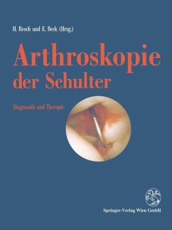 Arthroskopie der Schulter (eBook, PDF)