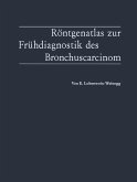 Röntgenatlas zur Frühdiagnostik des Bronchuscarcinom (eBook, PDF)