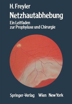 Netzhautabhebung (eBook, PDF) - Freyler, Heinrich