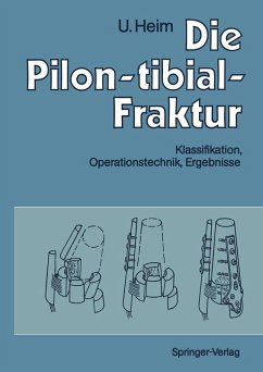 Cover Die Pilon-tibial-Fraktur (eBook, PDF)
