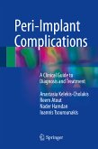 Peri-Implant Complications (eBook, PDF)
