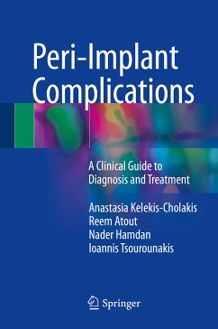 Peri-Implant Complications (eBook, PDF) - Kelekis-Cholakis, Anastasia; Atout, Reem; Hamdan, Nader; Tsourounakis, Ioannis