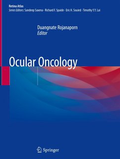 Ocular Oncology