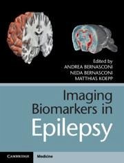 Imaging Biomarkers in Epilepsy