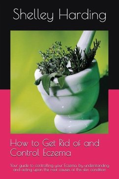 How to get Rid of and Control Eczema - Harding, Shelley